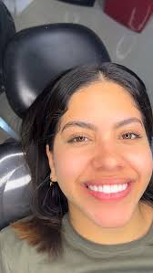 Porcelain Veneers 💎 #sonrisanatural 🦷 Dr. HAROLD SOLANO 🇨🇴🇧🇷 📲  3173821091 #diseñodesonrisa #disilicatodelitio #fonseca #guajira