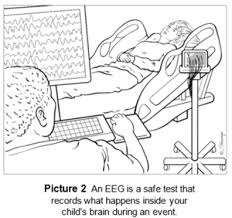 Treating the underlying psychological cause can often help to reduce the number of seizures or prevent them happening. Psychogenic Non Epileptic Events