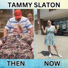 😱 Unbelievable! Tammy Slaton's New Look Season 8 After Leg Surgery Has Netizens Going Crazy!........... Full Here👇👇 https://people.donextop.com/ unbelievable-tammy-slatons-new-look-season-8-after-leg-surgery-has-netizens- going-crazy/
