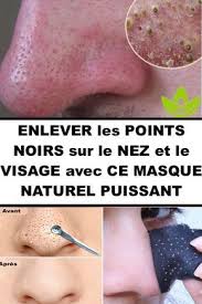 Comment Enlever Les Points Noirs Sur Le Visage Avec Ce Masque Naturel Beauty Care Beauty Hacks Body Hacks