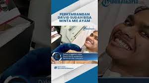 Sumber Biaya Pengobatan David Diungkap Sang Ayah, Ternyata Punya Black  Card, Kini Tembus Rp 1,2 M