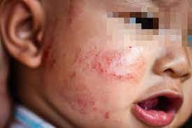 We did not find results for: Kenal Pasti Alahan Anak Anda Dan Cara Mengatasinya Famili Mstar
