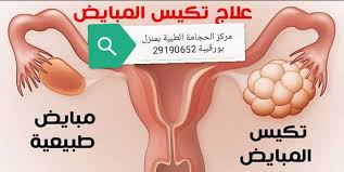 الحجامة الطبية للمساعدة على الإنجاب مركز الحجامة الطبية بمنزل بورقيبة Centre Hijema Menzel Bourguiba فيسبوك