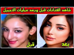 ‫شاهدوا الفنانات قبل وبعد عمليات التجميل لن تصدقوا أعينكم وشاهدوا كيف كانوا  وكيف أصبحوا تغير مذهل 👉💥 - YouTube‬‎
