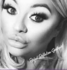 Get £10 off your next treatment if you refer a friend by the 1st of June…  right in time for summer ☀️👄💉 #advancednursepractitioner #botox  #lipfiller #southport