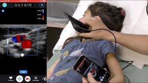 Butterfly Iq Pocket Sized Ultrasound Ultrasound First Ultrasound Ultrasound Technology
