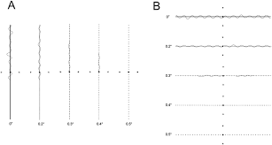 quantitative measurement of metamorphopsia using m charts in