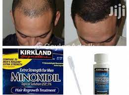 Each box contains 6 bottles and a dropper for a 6 month supply. Kirkland Minoxidil Hair Regrowth Treatment Home Facebook