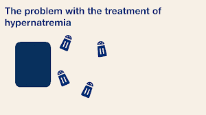 Image result for Hypernatremia