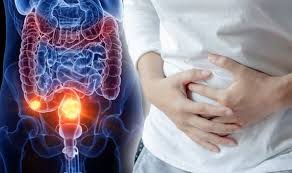 The blood coagulates and undergoes a series of changes as it passes through your colon, and becomes black, similar to coffee grounds. Bowel Cancer Symptoms Signs Of A Tumour Include Weight Loss Tiredness And Stomach Pain Express Co Uk