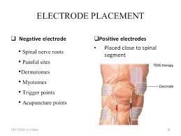 electrical stimulation