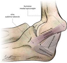 Medial ulnar collateral ligament injury, or a tommy john injury, is characterized by attenuation or rupture of the ulnar collateral ligament of the elbow leading valgus instability in overhead throwing athletes; The Pathoanatomy Of The Anterior Bundle Of The Medial Ulnar Collateral Ligament Journal Of Shoulder And Elbow Surgery