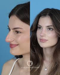 dr.muhammet.dilber (@dr.muhammet.dilber)