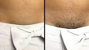 Laser hair removal is considered permanent by many, but technically it promises removal of 80% of just imagine a woman's crotch but with an overgrown or quintessentially enlarged clitoris for a penis. Pubic Hair Removal