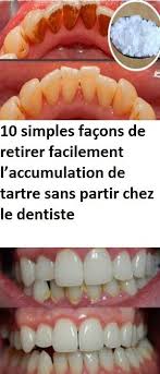 Pin On Minceur