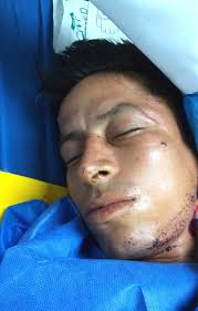 ▶️ #URGENTE || Servicio Social Se busca a los familiares del paciente Alex  Vinicio Armijos Armijos, de 26 años, quien fue traído al Hospital Teófilo  Dávila en ambulancia desde el hospital del