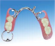 Maybe you would like to learn more about one of these? Jenis Dan Bahan Gigi Palsu Audy Dental