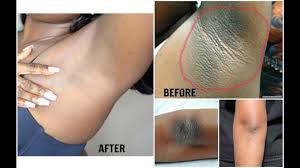 We did not find results for: 3 Simple Ways To Lighten Your Underarm Gubi 01 Limited