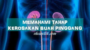 Pada tahap ini, sentiasa merujuk perkembangan dan masalah puan dengan doktor. Sakit Buah Pinggang Rosak Fahami Tahap Kerosakan Ohcantik Com