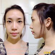 โบว์ เมลดา สะใจ บินไปงัดดั้งใหม่ที่เกาหลี เอากระดูกที่แตกในจมูกออก สาเหตุทำให้เลือดกำเดาไหลตลอด ตอนอากาศเปลี่ยนแปลง ได้กำไรทำแล้วสวย. à¸¨ à¸¥à¸¢ à¸ˆà¸™à¸› à¸‡à¸­à¸¥ à¸‡à¸ªà¸­à¸‡à¸¥ à¸²à¸™ à¸Ÿ à¸²à¸Š à¸­à¸„à¹‚à¸à¹à¸¥ à¸' à¹€à¸ˆ à¸²à¸‚à¸­à¸‡à¸™à¸¡à¸ à¸‡à¸Š à¸›à¹€à¸• à¸²à¹à¸£à¸à¸‚à¸­à¸‡à¹„à¸—à¸¢