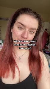 Skin Choice Breakout Patch