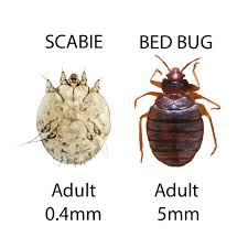 Image result for what does scabie look like