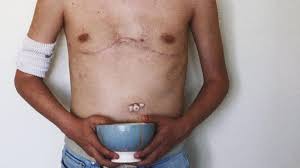 They will also perform a physical examination to assess the site of the injury and listen to the heart and lungs. My Cystic Fibrosis Scars Strong In The Broken Places