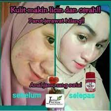 Sebab kesemuanya mempunyai peranan penting dalam men. Testimoni Jamu Nenek Sang Suria 2 Kedai Cadar Patchwork Syaqist Murah Berkualiti