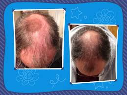 Hair relaxing is considered a must part for hair care. Get Healthy Hair Naturally Find Out How You Can Grow Back