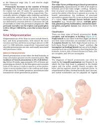 Image result for Brow Presentation