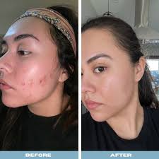 New esthetician business in Morton, IL