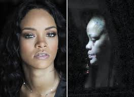 Michael, to monica (braithwaite), an accountant, and ronald fenty, a warehouse supervisor. Rihanna E Clicada Com Machucados No Rosto Apos Acidente Quem Quem News