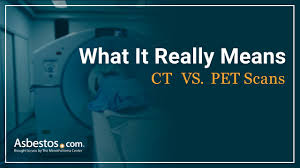 Check spelling or type a new query. Ct Vs Pet Scans For Mesothelioma Patients Youtube