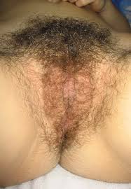 Schamhaar – Wikipedia