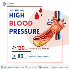 Image result for Hypertension