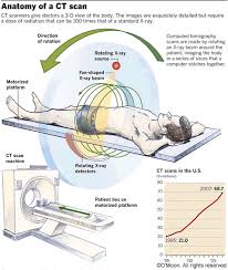 Cat Scan Computer Aided Tomography X Ray Is Rotated Around The Body And Many Slices Recorded A Comput Radiology Nuclear Medicine Medical Radiation Technologist