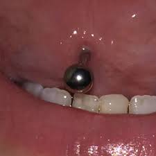 Snake eyes can cause a number of problems including damaged teeth, gum erosion and migration of the piercing. Ist Mein Neues Piercing Entzundete Zunge Zungenpiercing