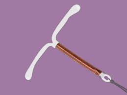 Le Stérilet Au Cuivre (Diu) : La Contraception Idéale ? | Cyclotest