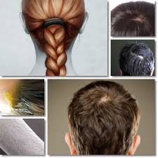 L'eccessiva produzione di sebo è la causa che rende la cute grassa e i capelli unti, oleosi e appiccicosi. 7 Efficaci Rimedi Contro I Capelli Grassi Vitamineproteine Com