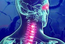 La esclerosis múltiple (em) es la más común de las enfermedades inflamatorias que dañan la cubierta de las fibras nerviosas (mielina) del sistema esclerosis múltiple. M3kthyyys7uabm