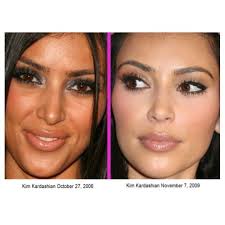 Yikes Notice A Difference Kardashian Plastic Surgery Plastic Surgery Photos Cosmetic Surgery