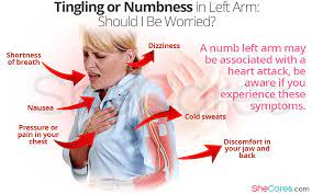 Pain in the left arm… this is caused by commingling (sharing) of the nerves supplying the arm with those that go to the heart, particularly the epicardium (outer lining). Numbness In Left Arm Heart Attack Chest Discomfort Arm Numbness