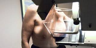 > cancers urologiques (rein et vessie). Cancer Du Sein Des Frais Trop Chers Pour Les Malades