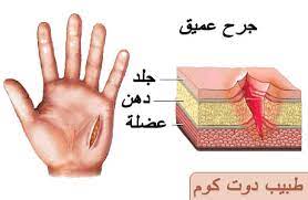 كيفيه علاج جرح بسرعه