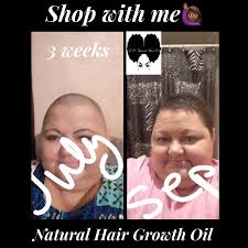 LM Natural Hair Growth oil