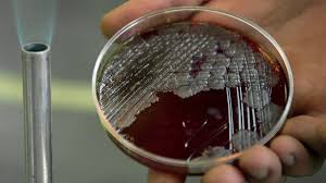 Image result for Anthrax