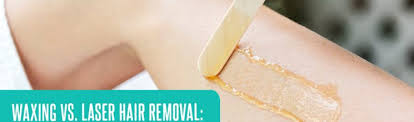 How effective is laser hair removal? Laser Hair Removal Vs Waxing A Choice For You To Make Safaa Elbanna