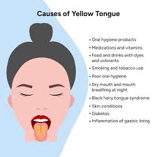Image result for yellow tongue infection