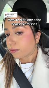 Makeup Tips for Hiding Acne Scars and Blemishes
