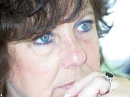 Fundraiser for Lacie Young by Matt Irwin : Darlene Lopiccolo's Battle